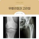 고려수재활요양병원 네이버블로그