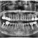 저스트치과기공소 이미지