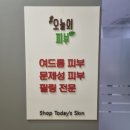 45 | 별내 여드름 샵오늘의피부 에서 별내 알라딘필 일주일후 솔직후기