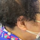 포낙보청기 이미지