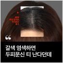 두피문신후기 방향을 바꾸면 인위적일까봐 걱정된다면