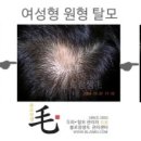 불로장생모