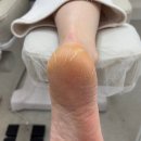 푸스케어 여주오학점 - 135559 | 여주발톱관리로 만족한 " 푸스케어 여주오학점 "에 방문후기