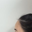 신사쑥사우나 | 신사역 피부과 이마필러 리뷰