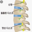 몽테스