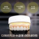 미인기공소 네이버블로그