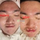 데코텍 이미지