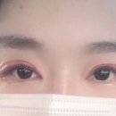 아이레이저랩 이미지