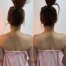 미남체육관 | 청주피부관리 중안부 리프팅 후기 청춘미남!