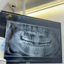 일산진사랑니치과의원 이미지