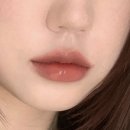 강남역 베르나의원 입술필러 후기 | 이브타이탄 같이 받은 7일차 솔직후기