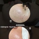 미엘피부관리 이미지