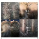 블랭크smp 이미지