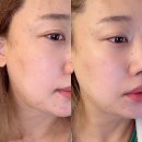 다드림 | 가산 피부관리 잘하는 곳! 다드림피부연구소 문제성피부관리 후기