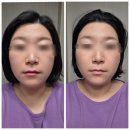 아나토미 | 천안얼굴경락 잘하는 아나토미 에스테틱 후기