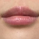 톱스타성형외과의원 | 광주 톱스타성형외과 “입술필러 리터치”_내돈내산 후기(2)