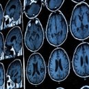 '文케어' 후 두통으로 MRI 찍은 중국인 9배 증가... "무임승차 논란 여전" 이미지