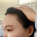 무지개헤어라인 | 사하구왁싱 추천, 이프닝왁싱 사하점 헤어라인+눈썹 왁싱 비포애프터