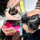 엑스포제일의원 | 청당동 탈모 천안 두피관리 찰스리 헤어테크