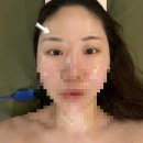 결혼상담 관리사 2급 | 오산 알포유 에너지테라피 리프팅 비대칭 교정 후기 오산대역 근처 더 어여쁜 피부관리