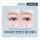 압구정비앤미의원