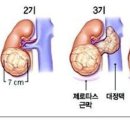 신장에 좋은 음식과 안좋은 음식 이미지