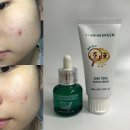 브링그린 징크테카 트러블 세럼 브링그린 징크테카 리페어 흔적 크림