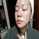 현기