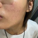 나라온의원 | 대흥역 피부과 전문 병원 추천 BEST 6곳