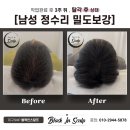 블랙인스칼프 이미지