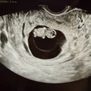 11215-구의2-526-1 | 정신 차려보니 만삭 🤰🏻?! 초기/중기/후기 과정부터 [임신 후기 단축 근무 &amp; 출산휴가 &amp; 육아휴직 신청...