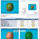 11650-7-12-1 | 사경 단두증 사두증 아기헬멧 교정 지오헬멧 7개월 착용 실제 변화 후기