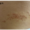 예인동물병원 | 13W. 임산부 대상포진 / 임산부 약처방 / 팜시버정 복용