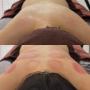 [인천 학익동 다이어트 체형관리] 1회 체험만으로 변화! 미라클뷰티 에너지테라피 후기