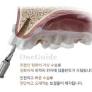 연세좋은치과기공소 이미지