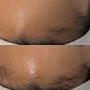 나현헤어뷰티 | [뷰티] 하루 완성 매끈한 속광 피부 관리, 춘천 뷰티오로라엘 본점