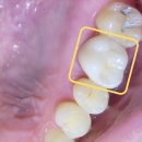 하얀치과기공소 이미지