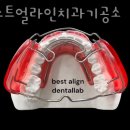 베스트치과기공소 이미지