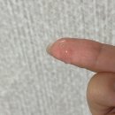 피부과 시술 후기 쥬베룩 리쥬란힐러 스킨부스터 효과 비교