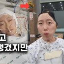 왼쪽 머리 뼈가 없는 저의 하루 일상입니다｜머리 뼈는 냉동실에 있어요｜It's my daily life without bones in 이미지