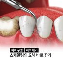율하사랑심는치과의원 | 치석 제거를 꼭 해야 하는 이유가 있을까요? 율하스케일링