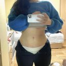 남사약국 | 대구 복부지방흡입 당일부터 3주차 상세 후기｜전후 효과·통증·붓기·멍