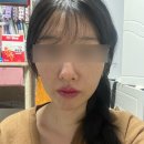 수목한의원 | 미올한방병원 비대칭치료 1,2회차 후기(내돈내산/가격공유)