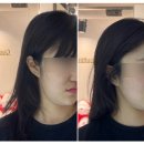 미인만들기 | 작은 얼굴 만들기 | 목동 피부관리 미인본가 목동점 | 경락 첫 후기