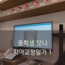 (주)사과나무 | 치아교정일기 1, 부천 사과나무치과 중학생 덧니 치아교정 1일차 후기, 발치교정 시작