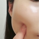 논현피부관리 이미지