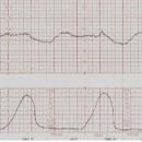 OPU-ET | 여성간호학 - 산부인과 병동 공부