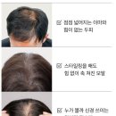 미토 이미지