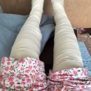 참하지외과의원 | 서울대입구 하지정맥류병원 베나실 혈관수술후기