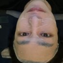 진비뇨기과의원 | 선릉 힐비뇨기과 잡티제거 예약 후기｜구운달걀된 썰 푼다